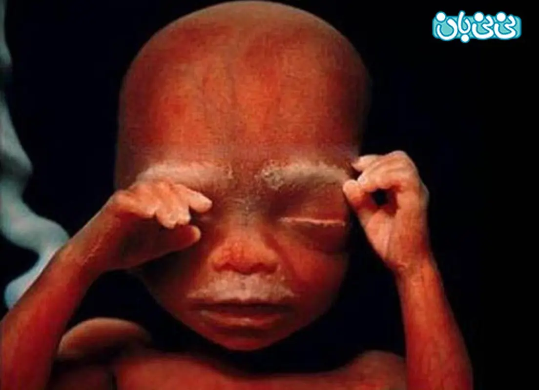 مراقبت دوران بارداری، سونوگرافی پارمیس