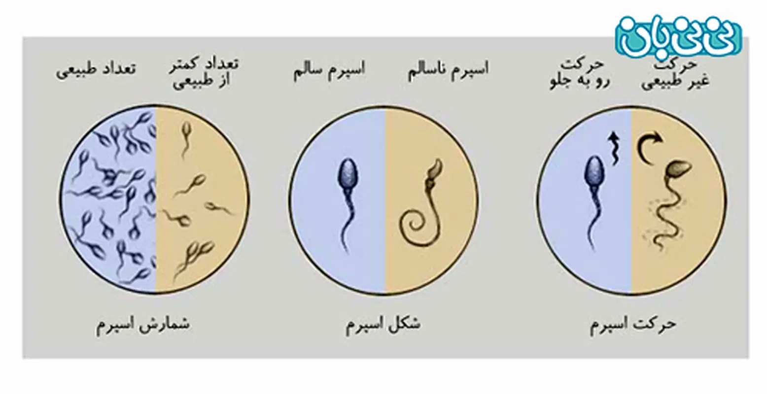 تعداد اسپرم نرمال چقدر است؟