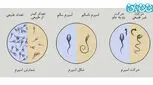تعداد اسپرم نرمال چقدر است؟