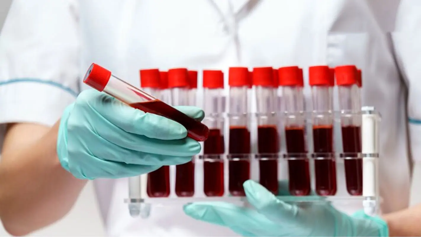 آزمایشات ضروری قبل ازدواج/ ویدئو