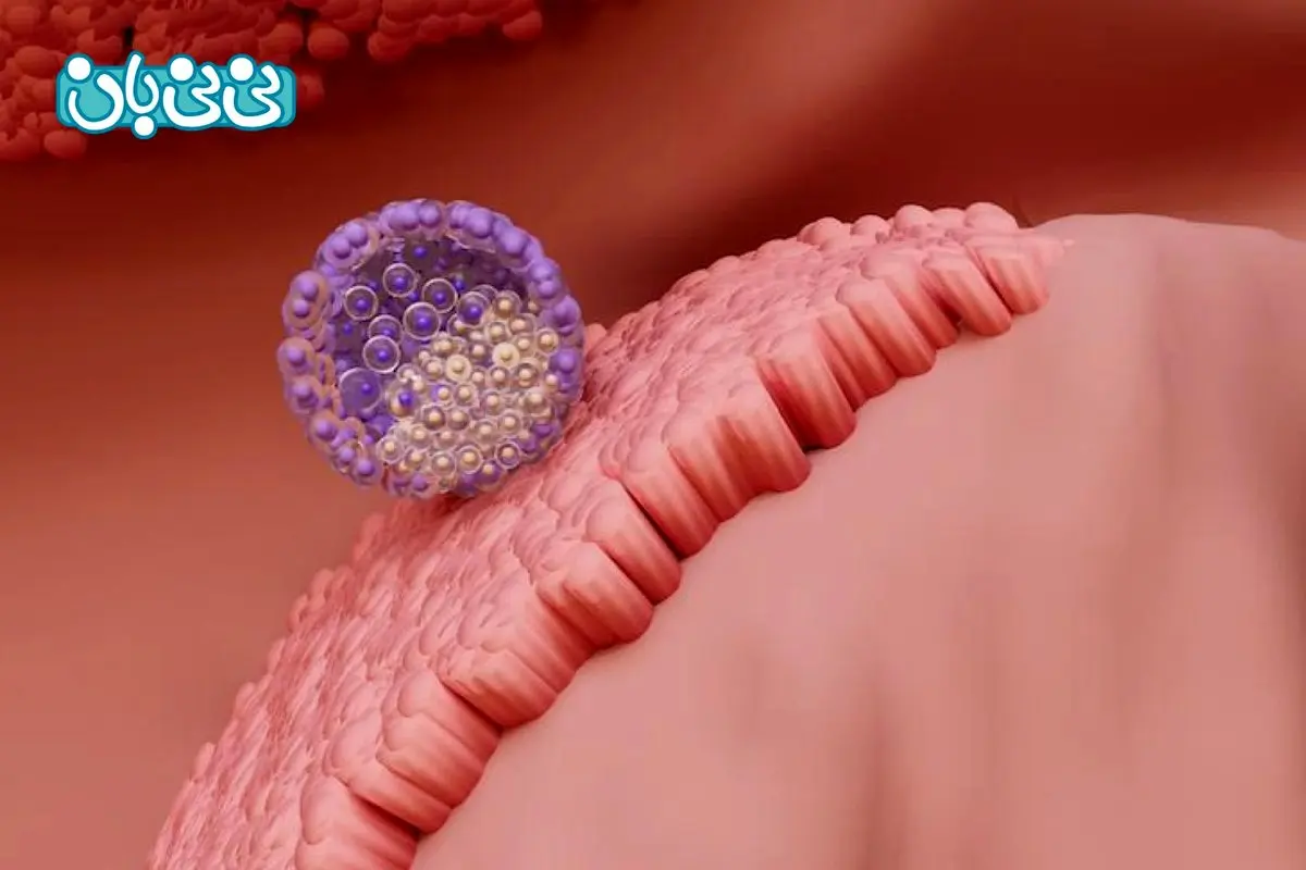 علائم لانه گزینی جنین _ عوامل موثر و زمان شروع لانه گزینی موفق