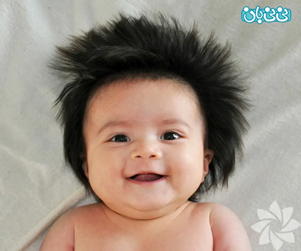 پرپشت شدن موی بچه، در بارداری چکار کنم؟