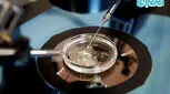 همه چیز در مورد ivf، آنچه باید بدانید