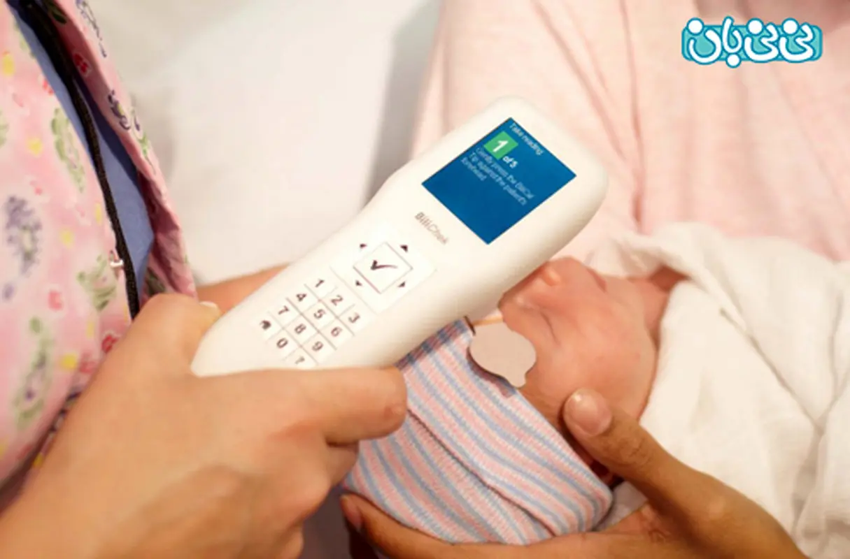 تست زردی نوزاد در منزل، حد مجاز بیلی روبین