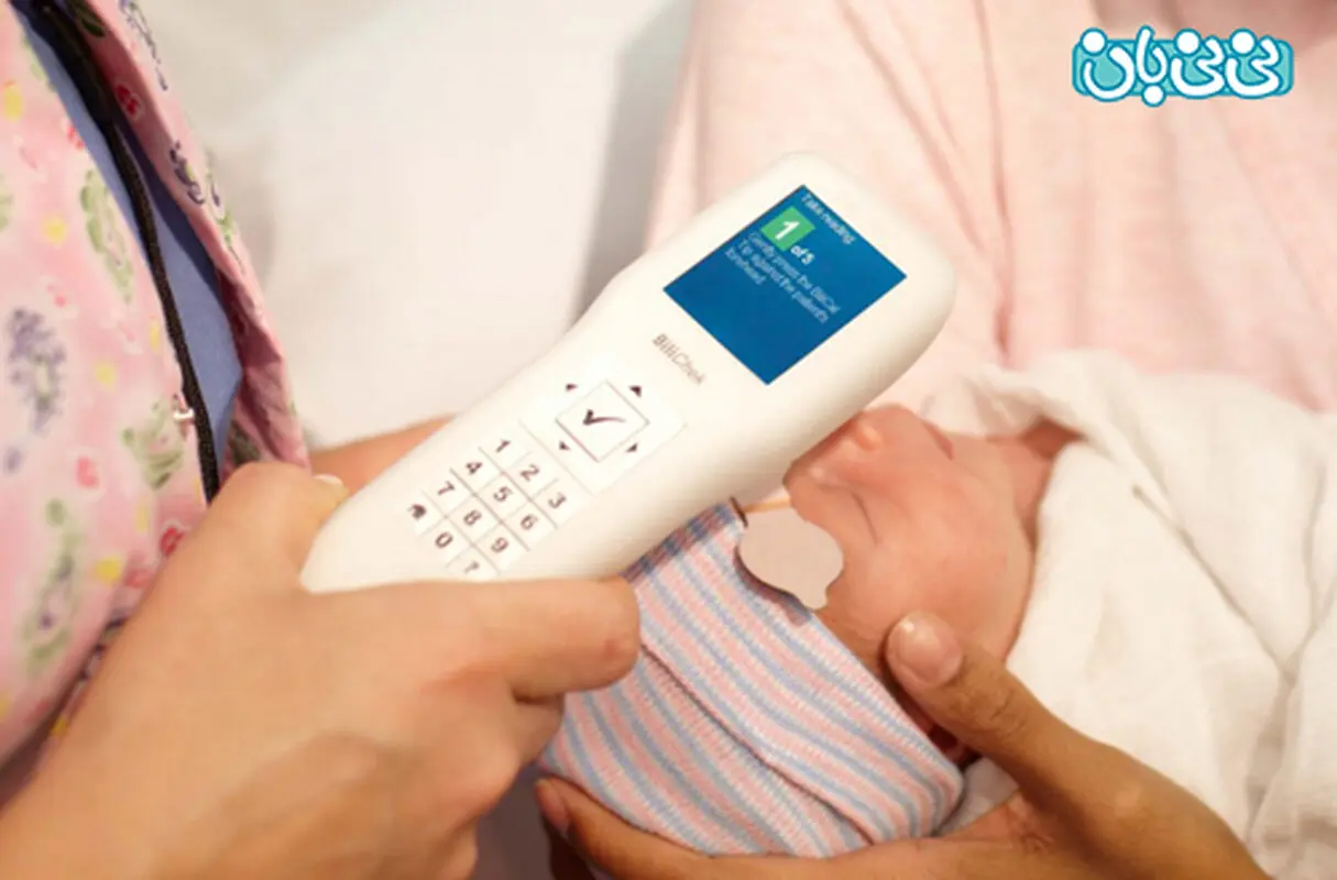 تست زردی نوزاد در منزل، حد مجاز بیلی روبین