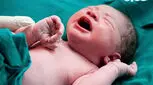 سزارین در هفته چندم بارداری انجام می شود؟