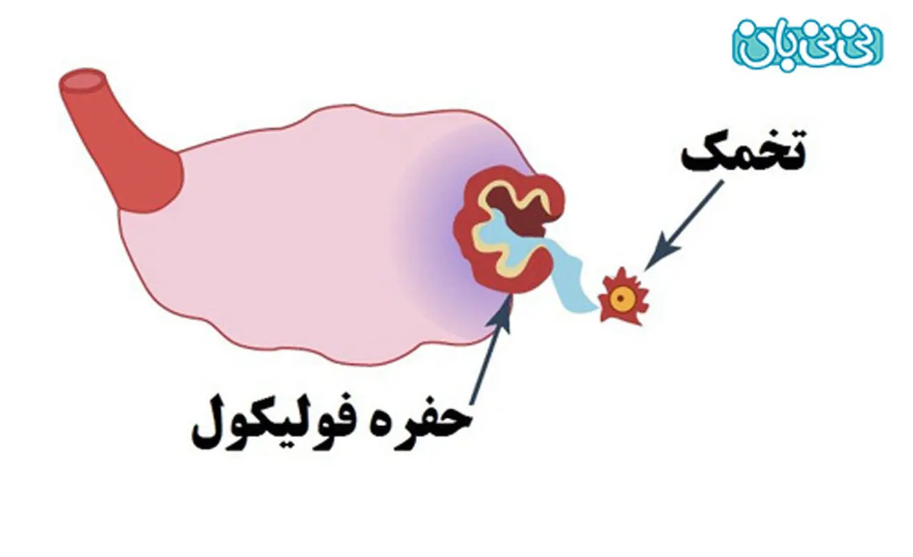 اندازه مناسب فولیکول برای بارداری، می دانید؟