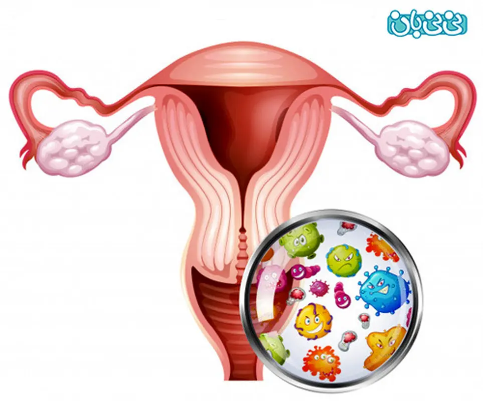 انواع ترشحات واژن، دلشوره‌های بی‌پایان