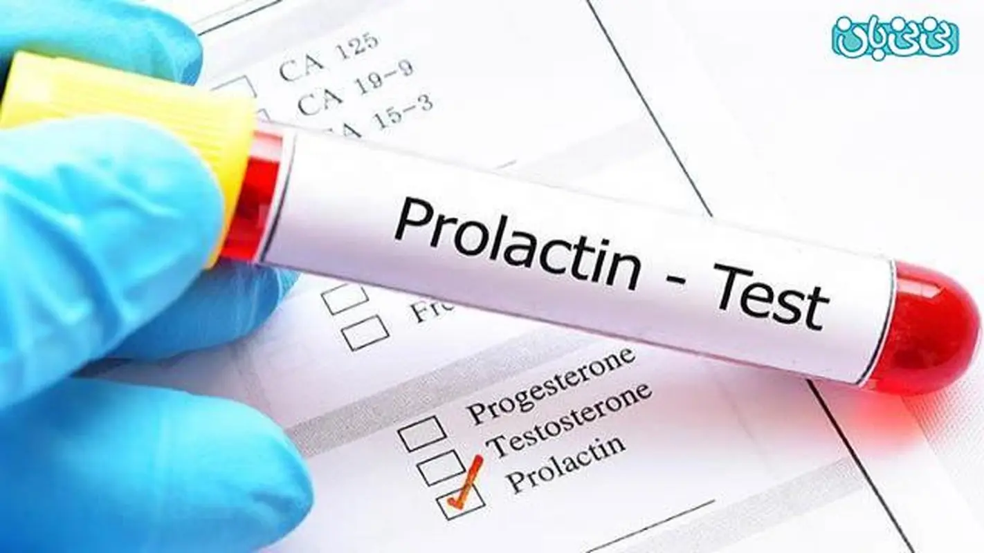 شرایط آزمایش پرولاکتین، آنچه باید بدانید