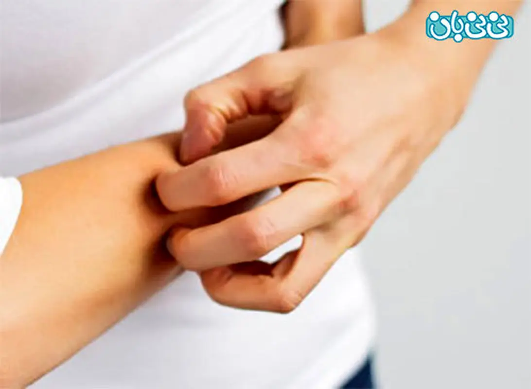 علائم کلستاز در بارداری، چیست؟