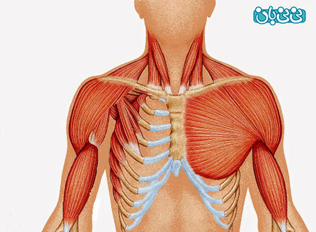 بیماری مادرزادی نوزادان، سندرم پولاند