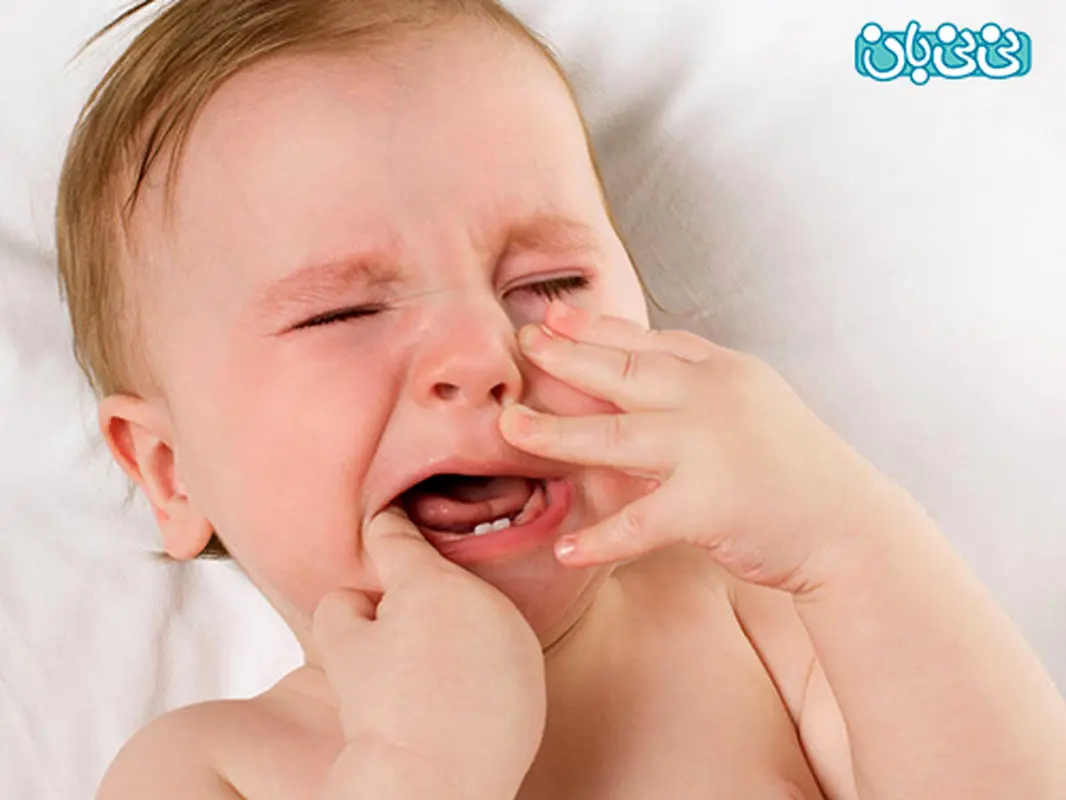 آفت دهان کودک، راهکارهای درمانی