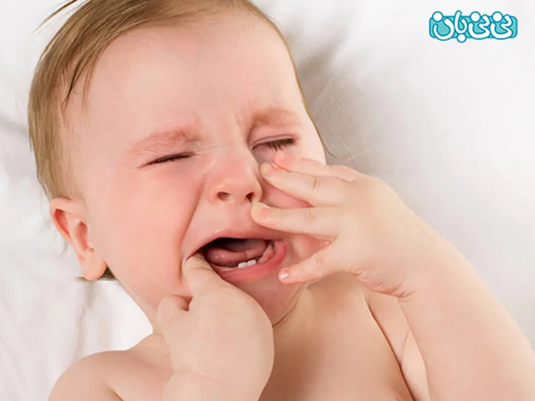 آفت دهان کودک، راهکارهای درمانی