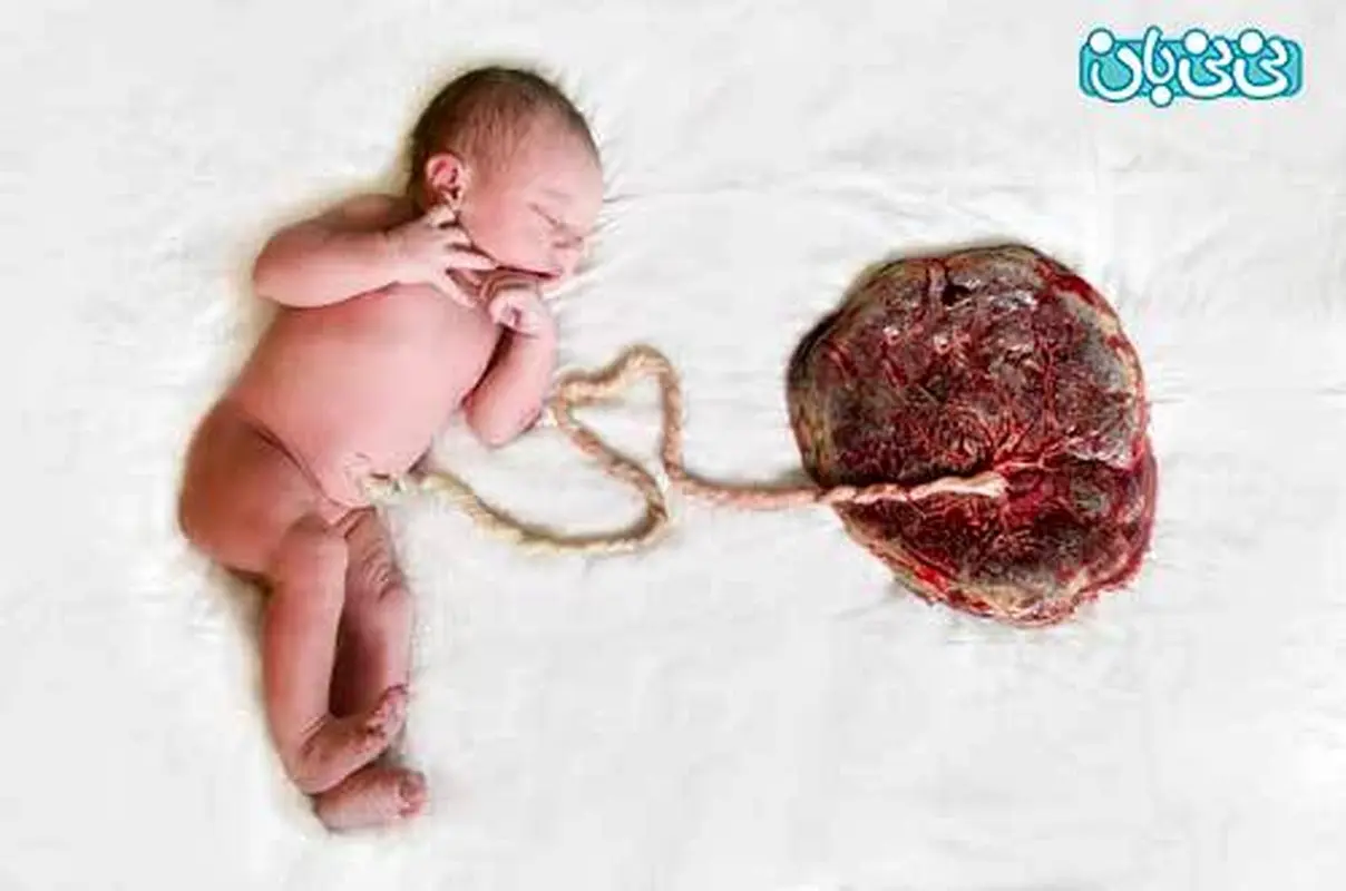 چگونگی تشکیل بند ناف جنین