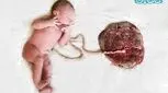 چگونگی تشکیل بند ناف جنین