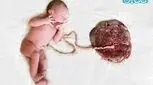چگونگی تشکیل بند ناف جنین