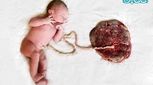 چگونگی تشکیل بند ناف جنین