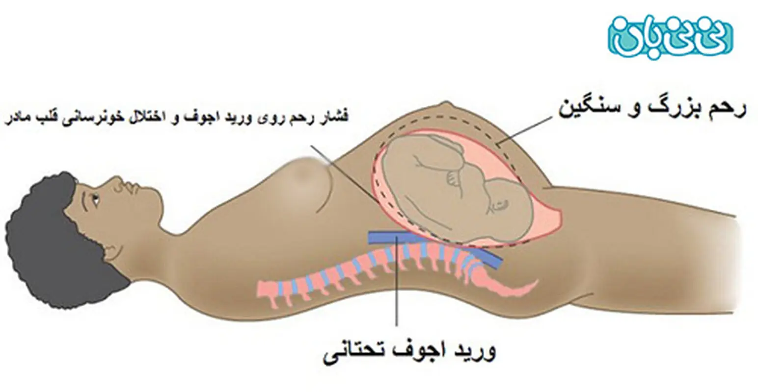 مضرات دمر خوابیدن در بارداری