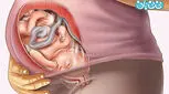 علائم هفته سی و نهم بارداری