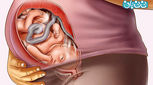 علائم هفته سی و نهم بارداری