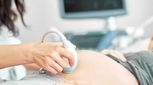 مایع آمنیوتیک کم در بارداری (الیگو هیدرآمنیوس)