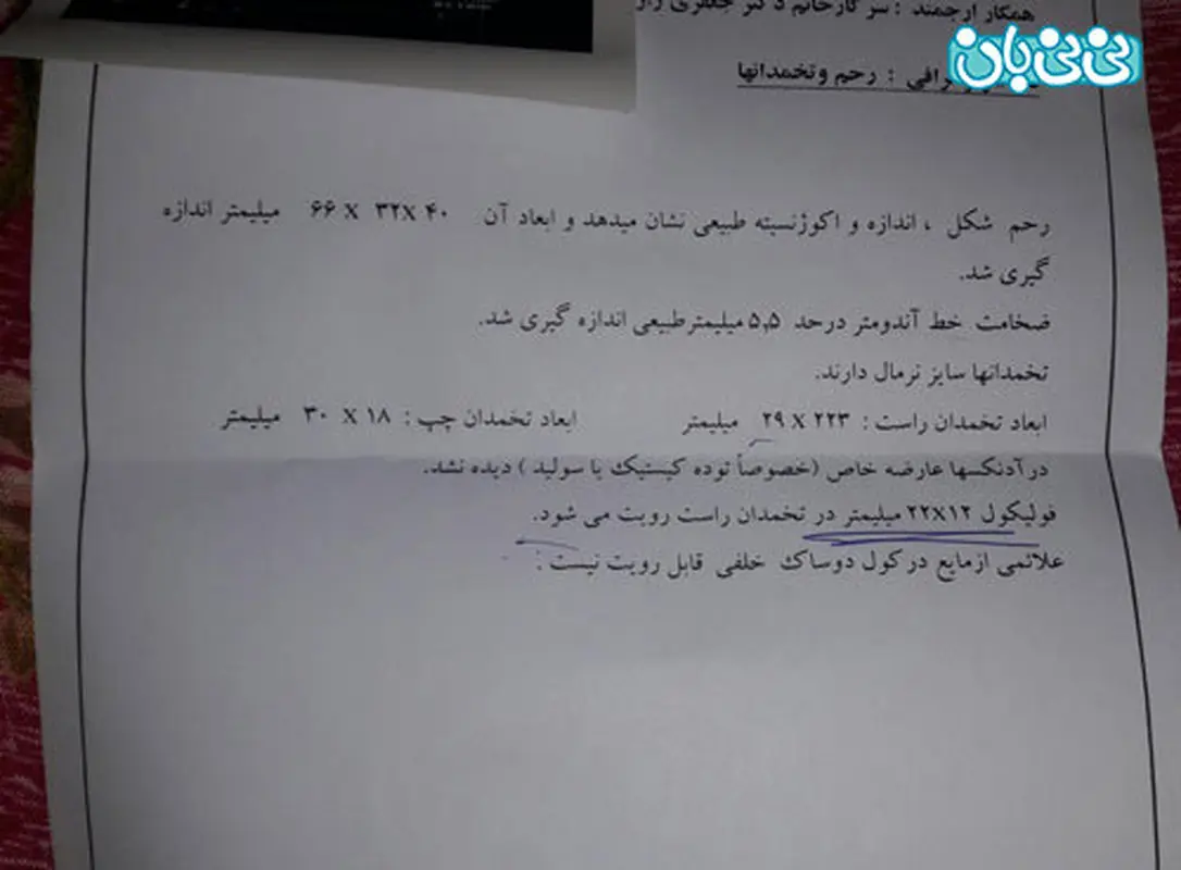 درمان تخمدان پلی کیستیک، دارو های تحریک تخمک گذاری موثره؟