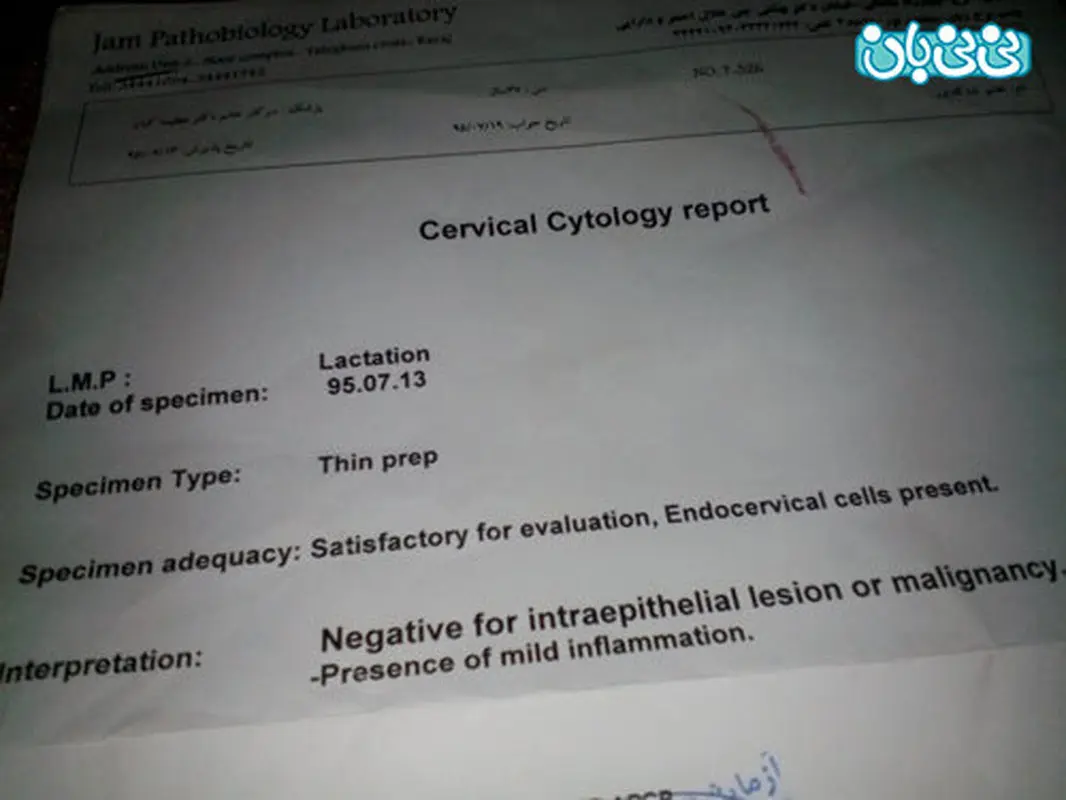 جواب پاپ اسمیر چگونه است؟