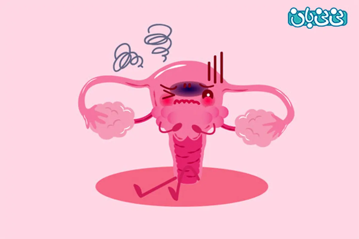 وجود فولیکول ریز در تخمدان، مشکل بدیه؟