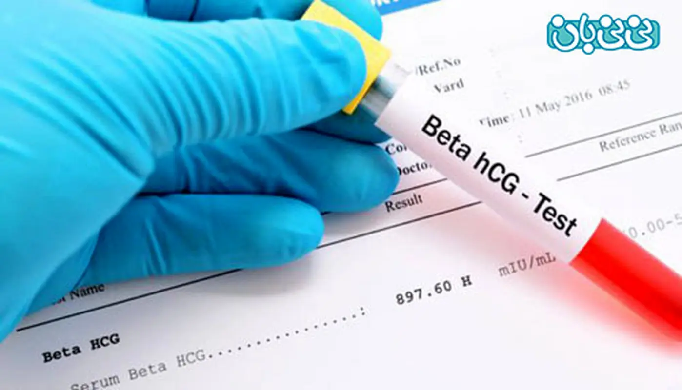 آزمایش بتا در بارداری، کی انجام میشه؟