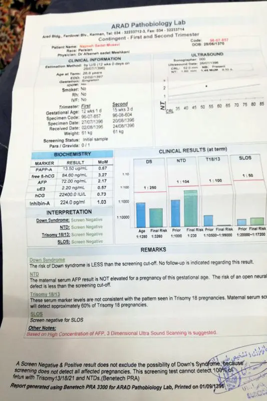 تفسیر آزمایش غربالگری دوم، نتیجه چطوره؟