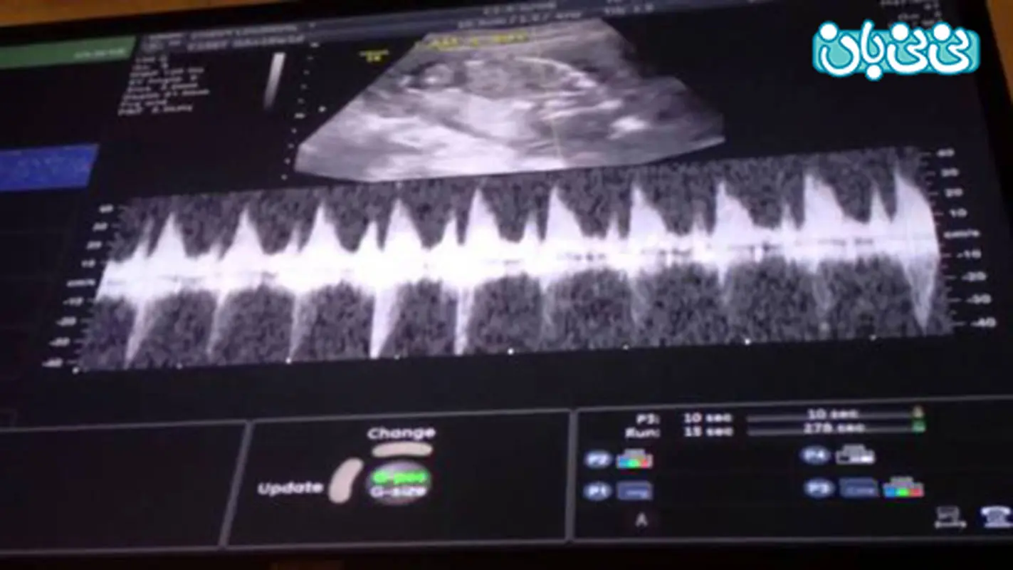 ضربان قلب جنین چند باید باشد؟