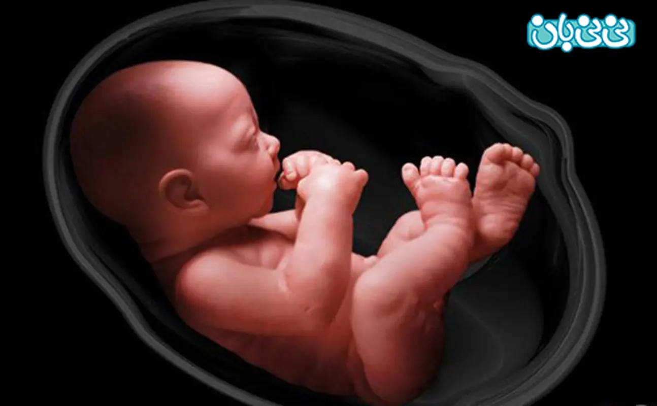 کیست کوروئید پلکسوس، همه جنین ها دچار می شوند؟