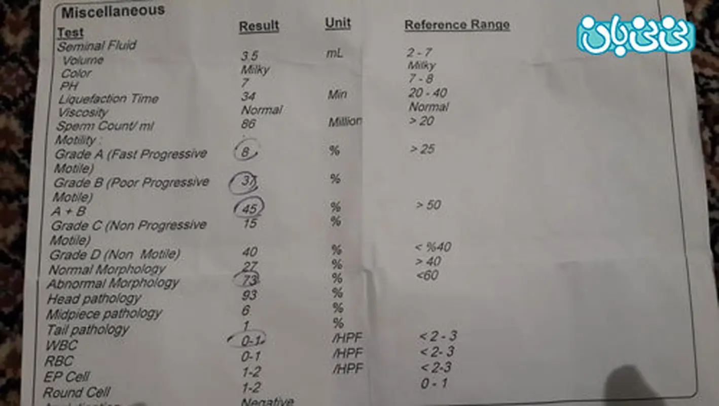 آزمایش بعد از عمل واریکوسل، امیدی هست؟
