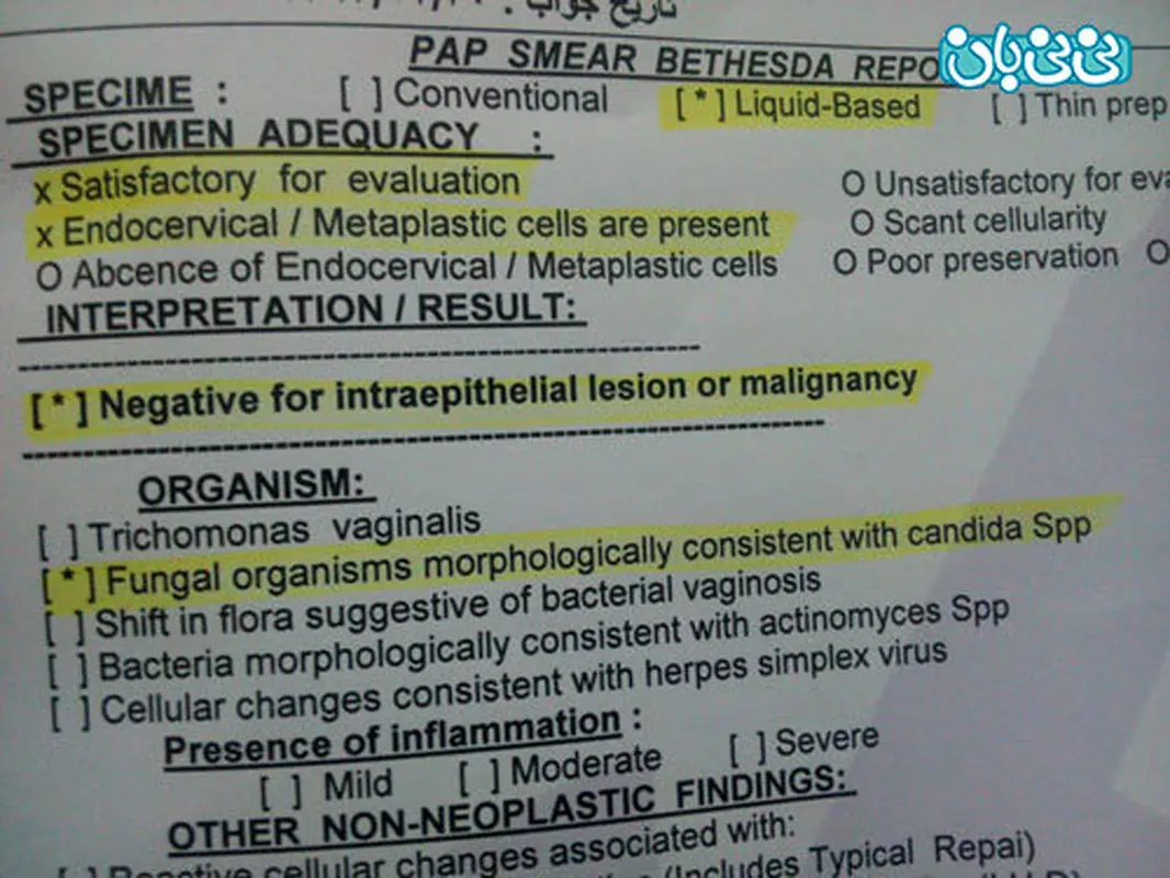 جواب ازمایش پاپ اسمیر، نتیجه چیست؟