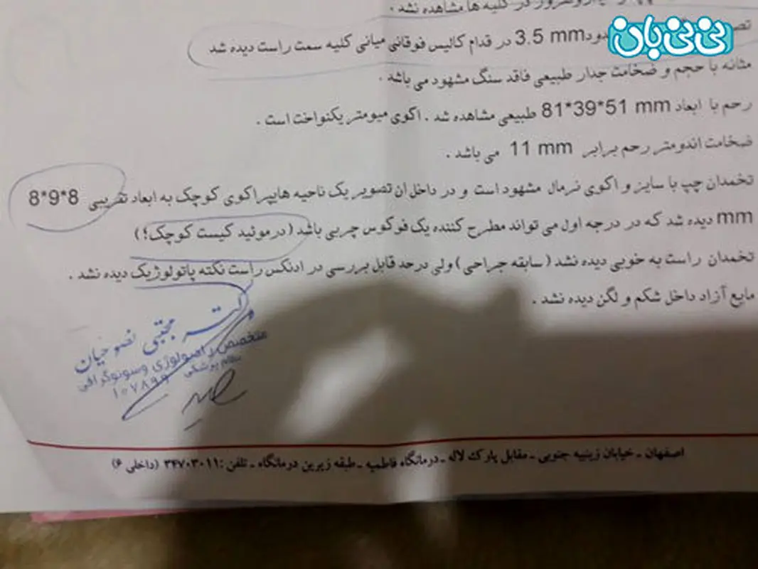 کیست اکوفری در بارداری، تبدیل به جامد میشه؟