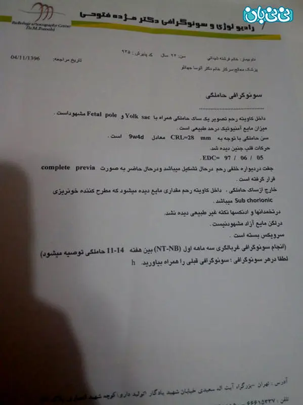 جفت سرراهی در بارداری، مسببه خونریزی منه؟