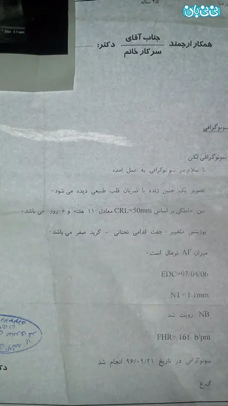 نتیجه سونوگرافی آنومالی، مشکل داره؟