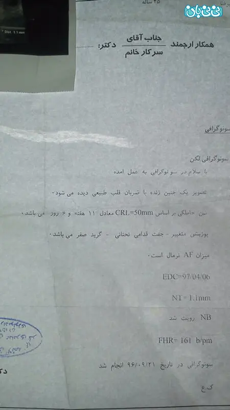 نتیجه سونوگرافی آنومالی، مشکل داره؟