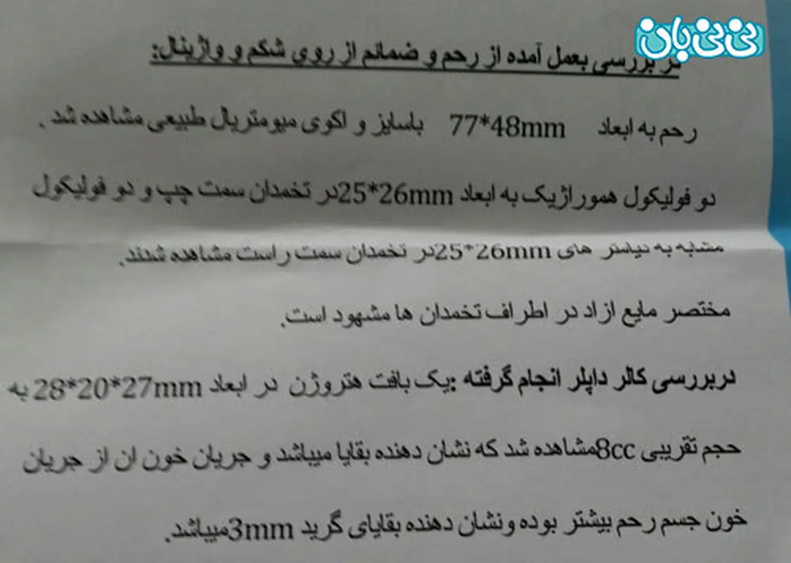 دفع بقایای سقط، داروی گیاهی موثره؟