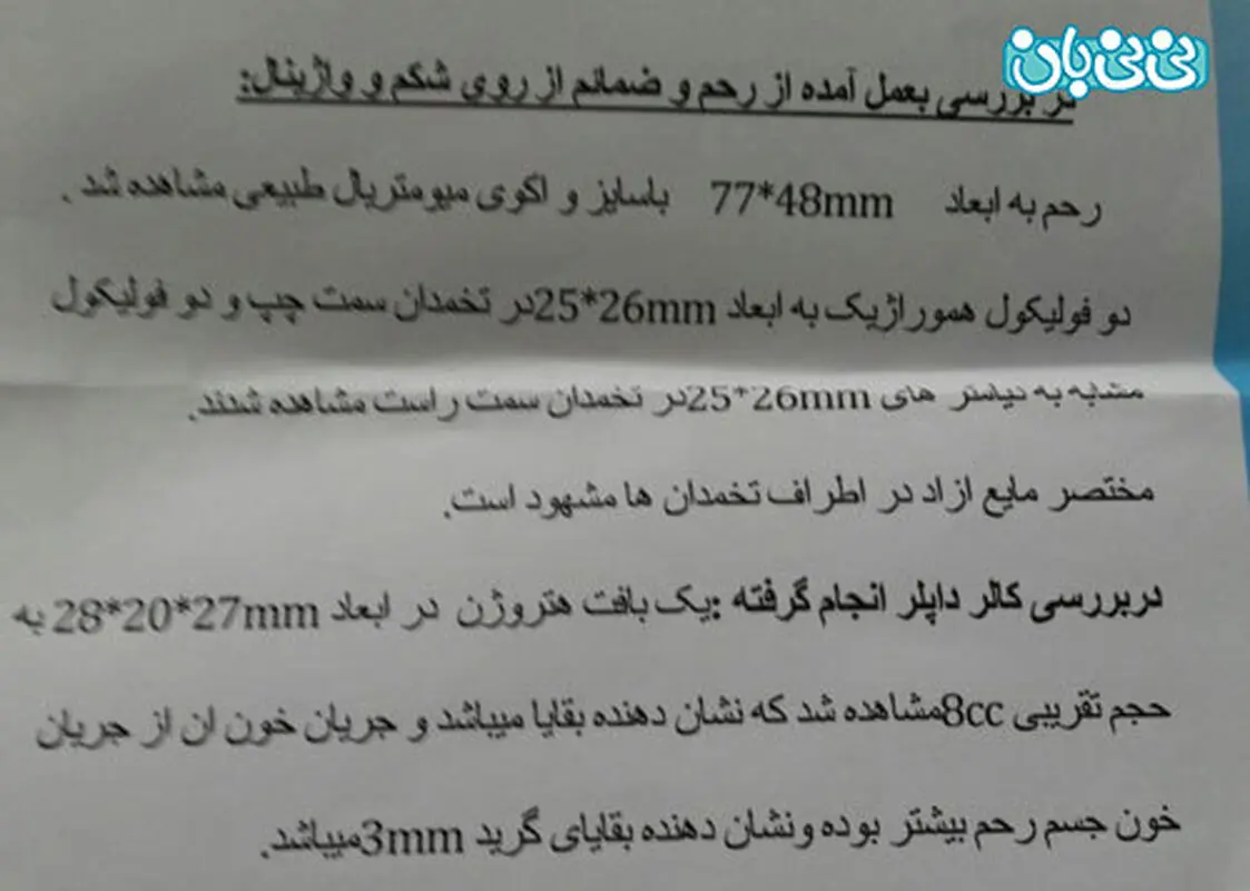 دفع بقایای سقط، داروی گیاهی موثره؟