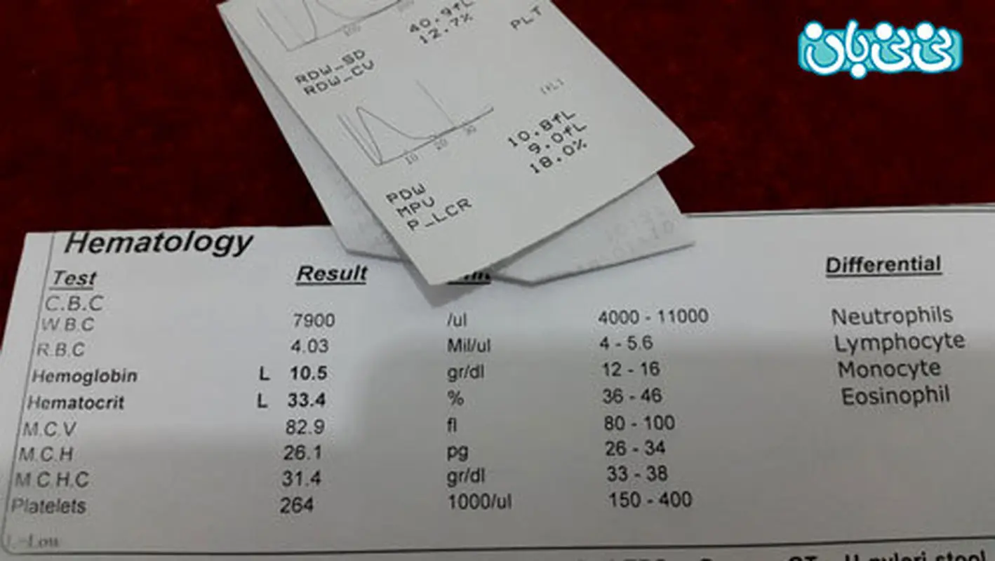 نتیجه ازمایش تیروئید، کم کاره یا پرکار؟
