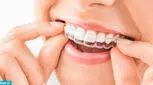 ارتودنسی متحرک چه مزایا و معایبی دارد؟