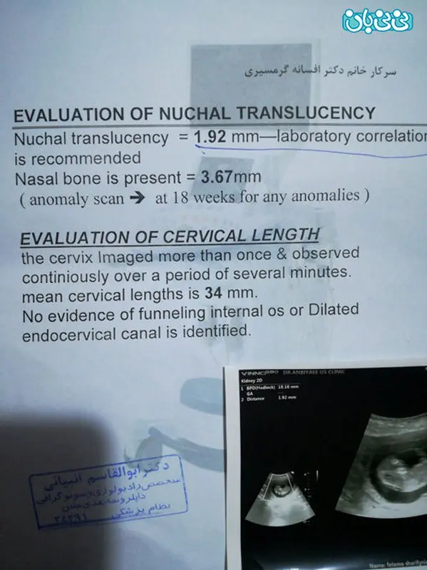 نتیجه سونوگرافی غربالگری، آیا مشکلی داره؟