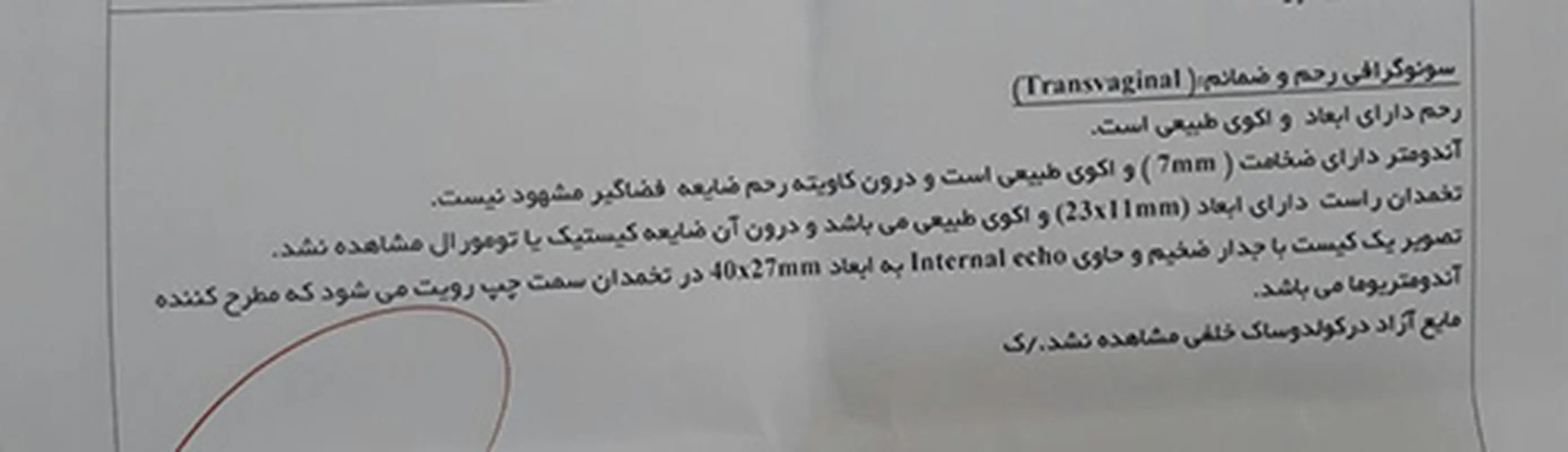 ایجاد کیست بعد از سقط، علت چیست؟