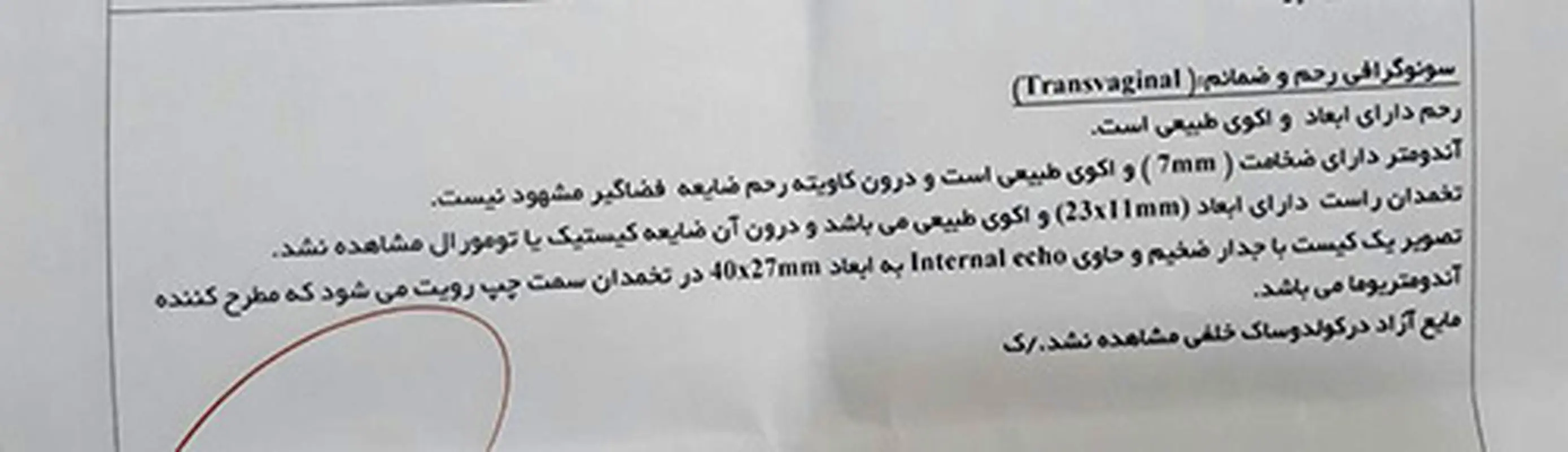 ایجاد کیست بعد از سقط، علتش چیه؟