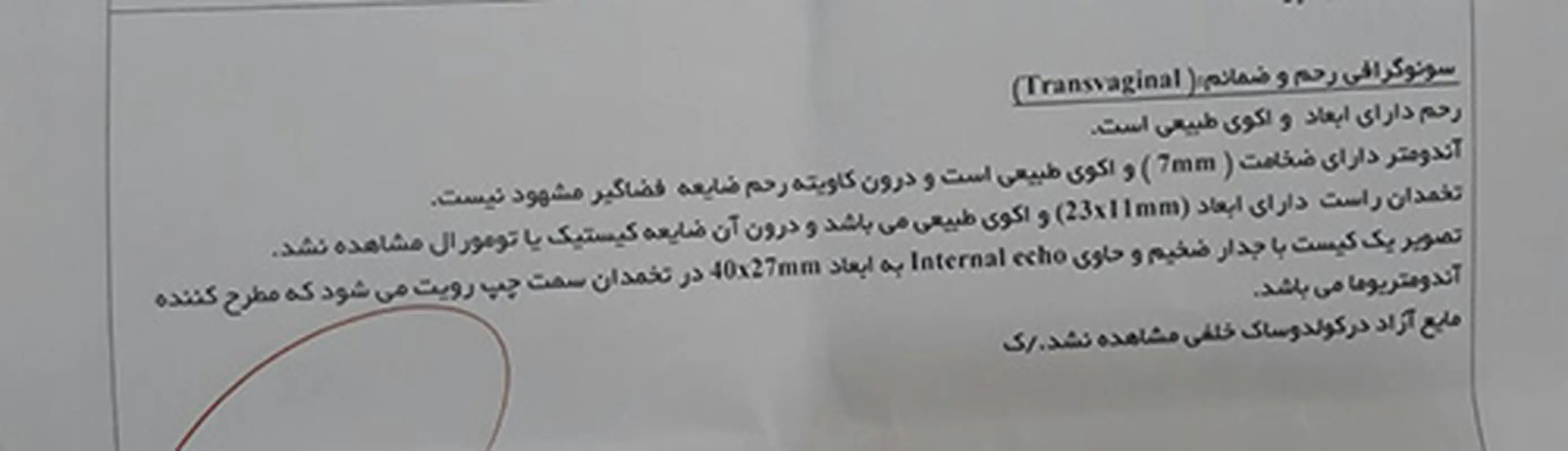ایجاد کیست بعد از سقط، علتش چیه؟