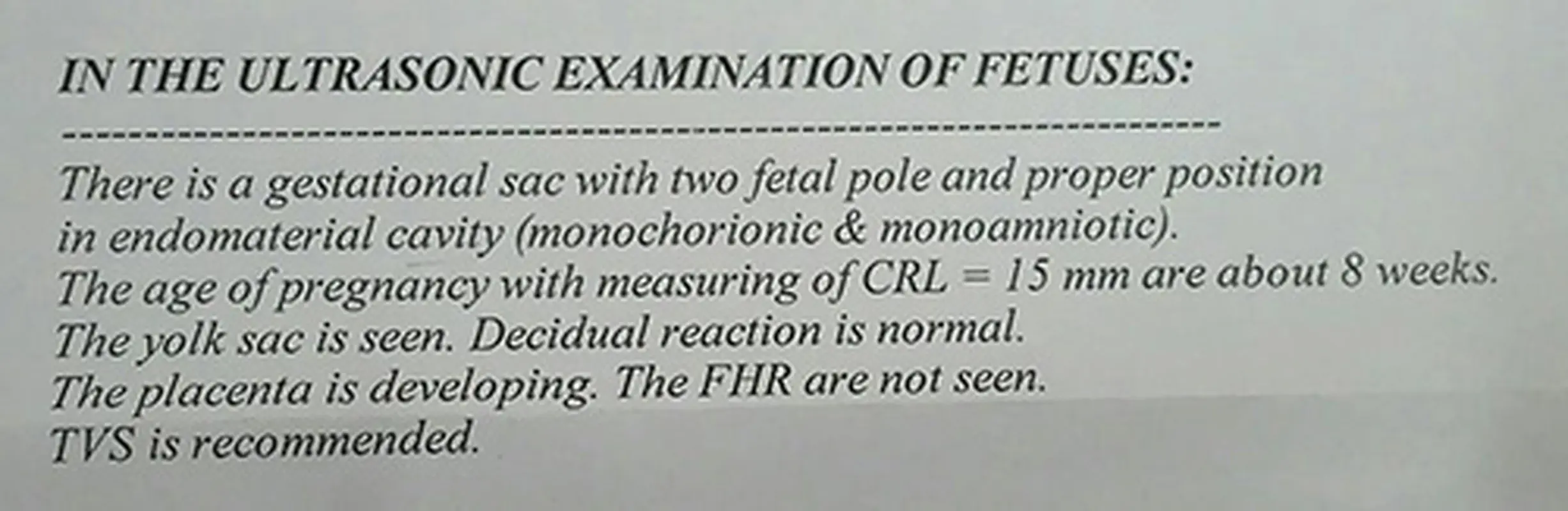 نشنیدن ضربان قلب جنین، دوقلو باردارم