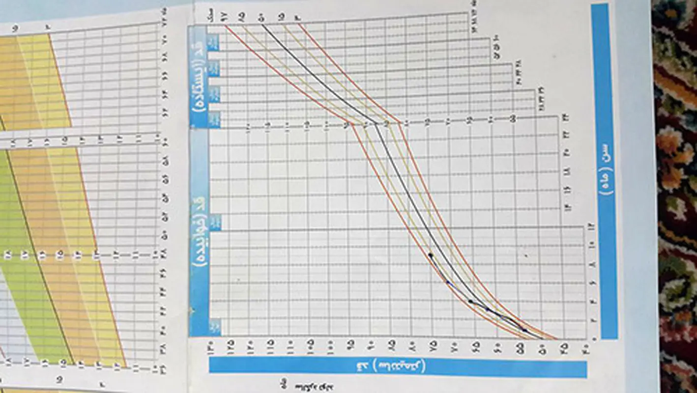 دور سر نوزادم کم است؟