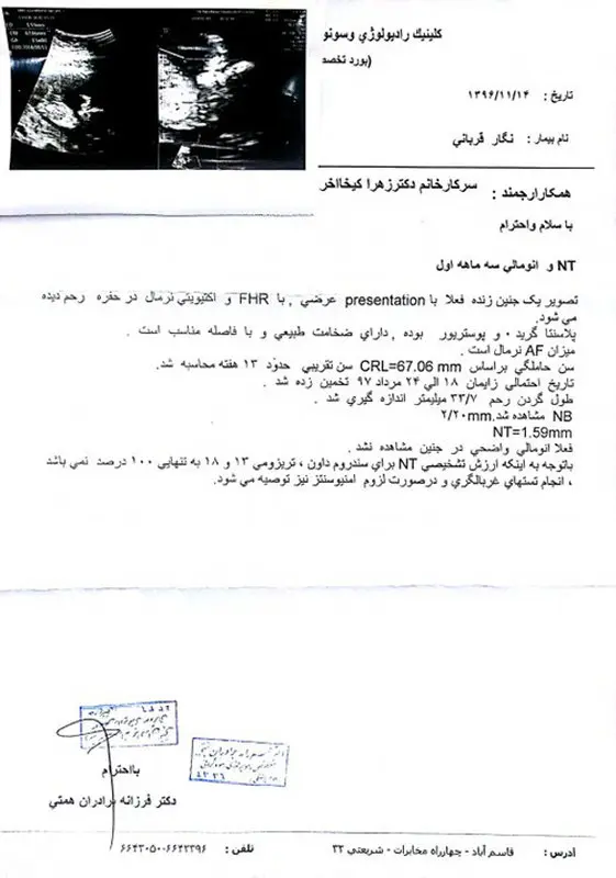 جواب آزمایش آمنیوسنتز، لطفا تفسیر کنید