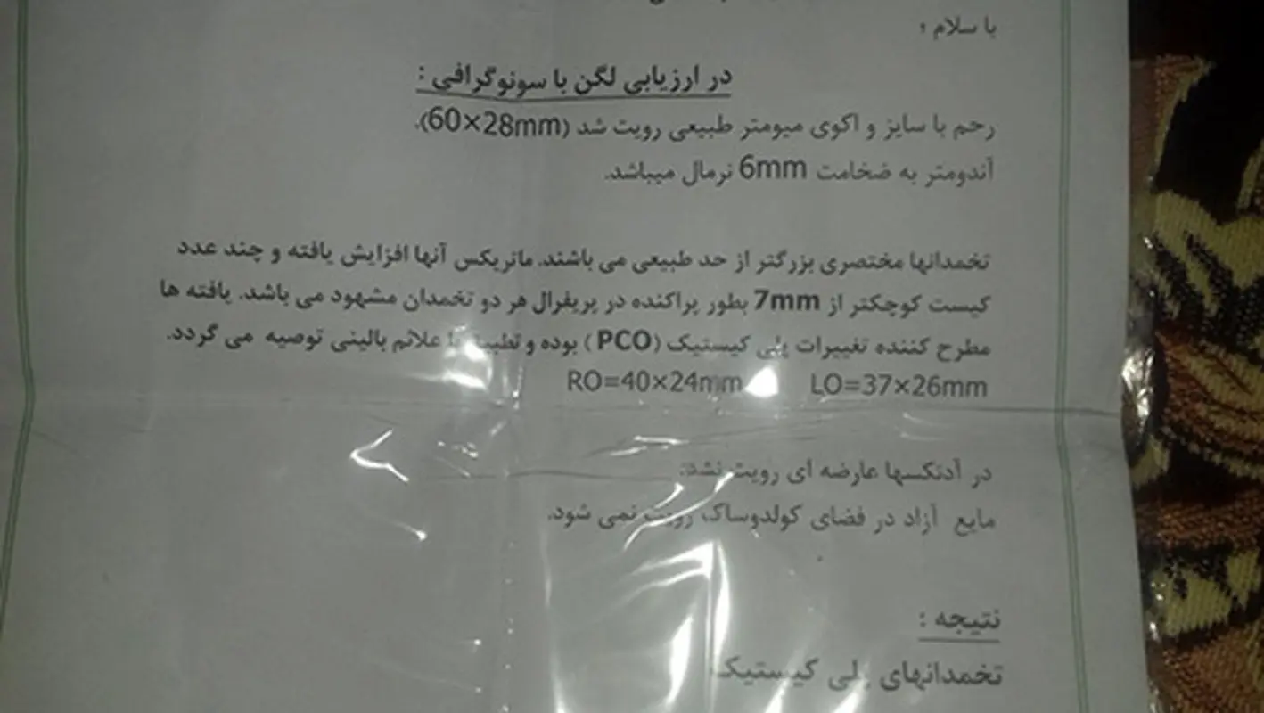 بیماری سندروم داون در جنین، چند درصد ارثیه؟